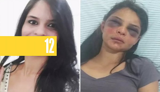 Mulher Fica Rosto Desfigurado Ap S Apanhar E Ficar H Amarrada