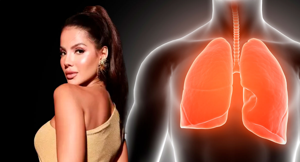 Embolia Pulmonar Morte De Influenciadora E Estrela De Reality Show