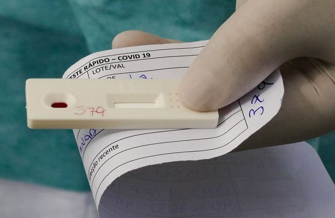 Estudo aponta primeira morte por reincidência de Covid-19 em paciente de Aracaju - News Rondônia