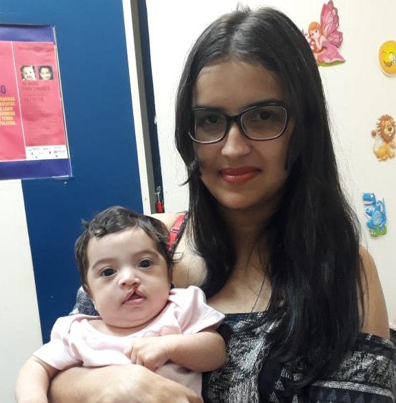 CIRURGIAS PARA CORREÇÃO DE LÁBIO LEPORINO ESTÃO SENDO REALIZADAS NO HOSPITAL DE BASE ARY PINHEIRO EM PORTO VELHO - News Rondônia