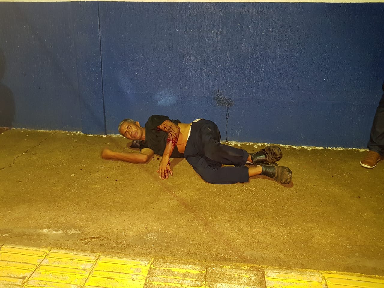 HOMEM LEVA VÁRIAS FACADAS APÓS REAGIR A ASSALTO; SUSPEITO É PRESO EM SEGUIDA - News Rondônia