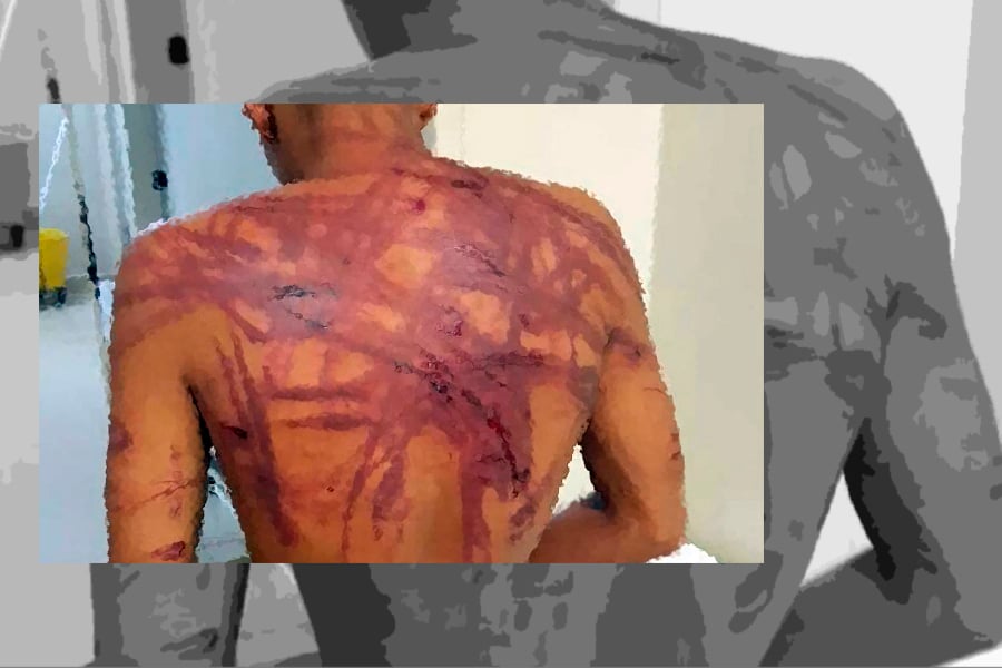 ESPANCADO: Homem é socorrido após ser surrado no bairro Planalto - News Rondônia