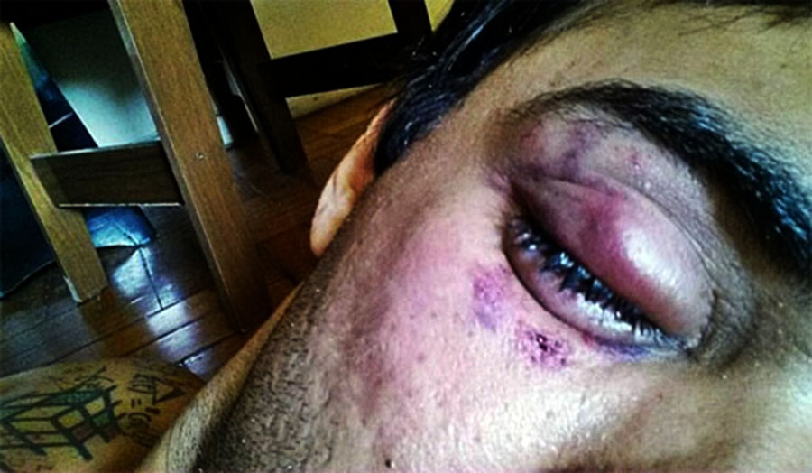 HOMEM É ESPANCADO POR AMIGO DURANTE BEBEDEIRA NA ZONA SUL - News Rondônia