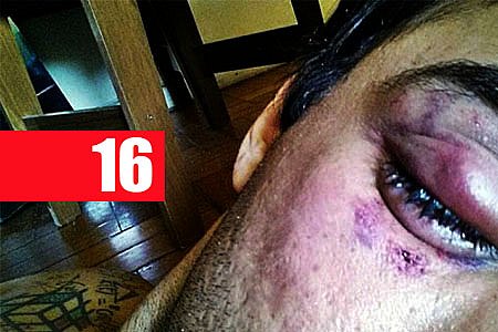 HOMEM É ESPANCADO POR AMIGO DURANTE BEBEDEIRA NA ZONA SUL - News Rondônia