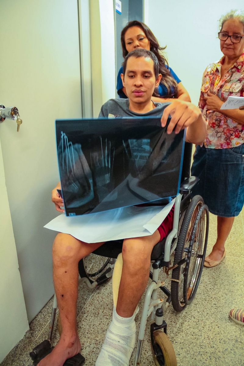 MAIS DE 270 PACIENTES JÁ FORAM ATENDIDOS PELO AMBULATÓRIO DE TRAUMA ORTOPÉDICO EM UM MÊS DE FUNCIONAMENTO - News Rondônia