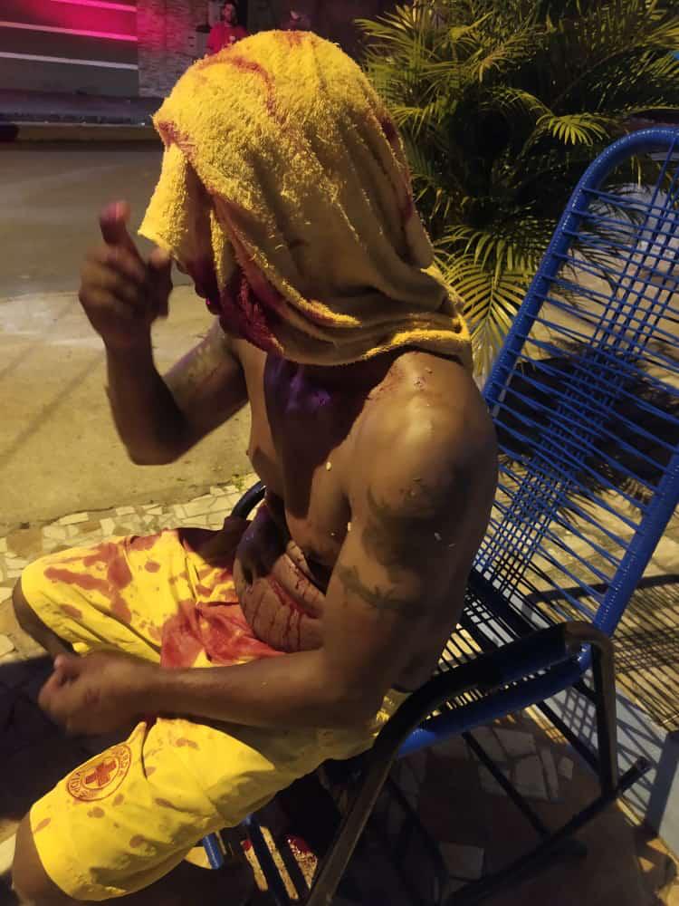 FOTOS - Homem sofre atentado à tiros em Ji-Paraná e acaba sendo baleado na cabeça - News Rondônia
