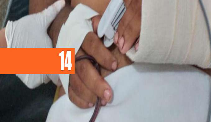 BANDIDOS INVADEM HOSPITAL E EXECUTAM PACIENTE A TIROS NO AMAZONAS - News Rondônia