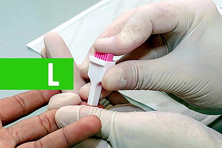 AGEVISA ORIENTA PARA USO DE NOVO MÉTODO PREVENÇÃO AO HIV - News Rondônia
