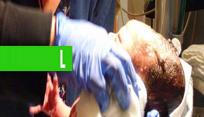 OBSTETRA É SUSPENSO APÓS BEBÊ NASCER SEM ROSTO EM PORTUGAL - News Rondônia