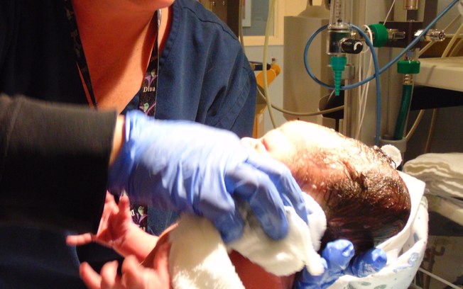 OBSTETRA É SUSPENSO APÓS BEBÊ NASCER SEM ROSTO EM PORTUGAL - News Rondônia