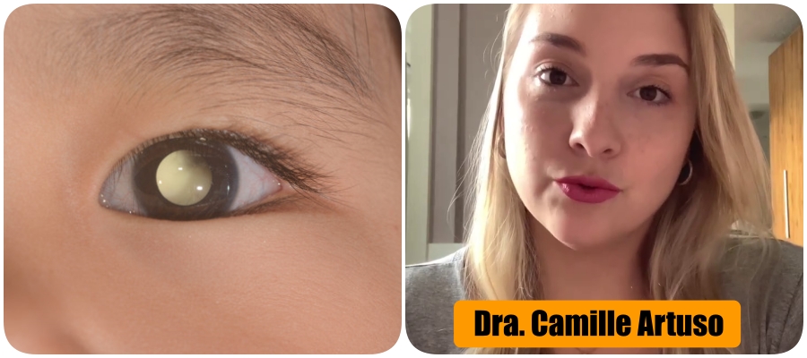 Oftalmopediatra explica o que é Retinoblastoma, câncer ocular que afeta Lua, filha de Tiago Leifert - News Rondônia