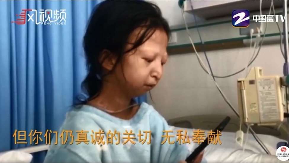 POBREZA NA CHINA: MORRE JOVEM QUE SE ALIMENTOU SÓ DE ARROZ E PIMENTA POR 5 ANOS - News Rondônia