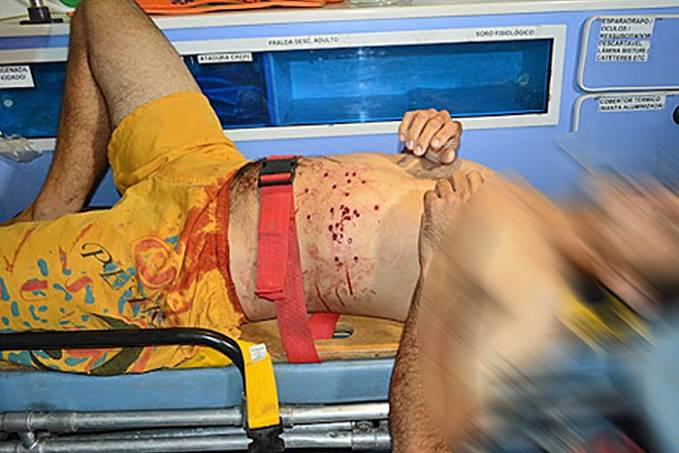 EM BEBEDEIRA - Homem tenta assediar filha do amigo e leva tiro de chumbeira - News Rondônia
