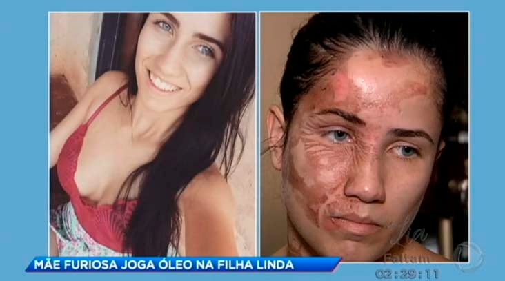 VEJA VÍDEO: MÃE JOGA ÓLEO QUENTE NA FILHA LINDA - MOTIVO É CHOCANTE - News Rondônia