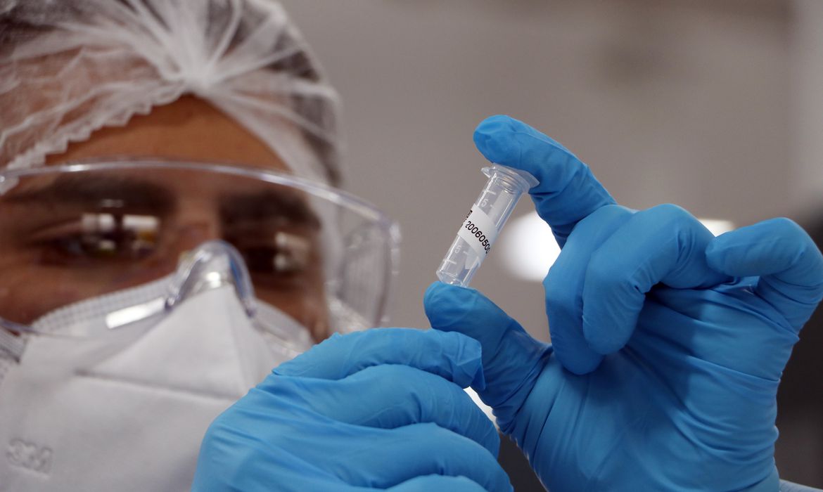 Síndrome respiratória aguda grave mostra tendência de queda - News Rondônia