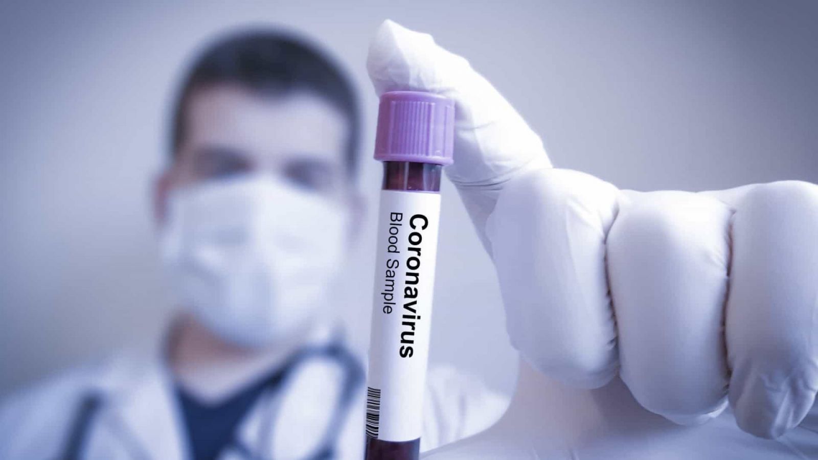 COVID19: APÓS 1ª MORTE, CASOS CONFIRMADOS CHEGAM A 291 NO BRASIL - News Rondônia