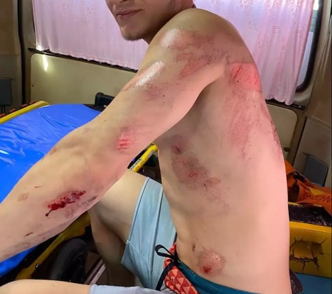 UFC: LUTADOR RUSSO É ATROPELADO E DEIXA O CARD DO UFC 248 - News Rondônia