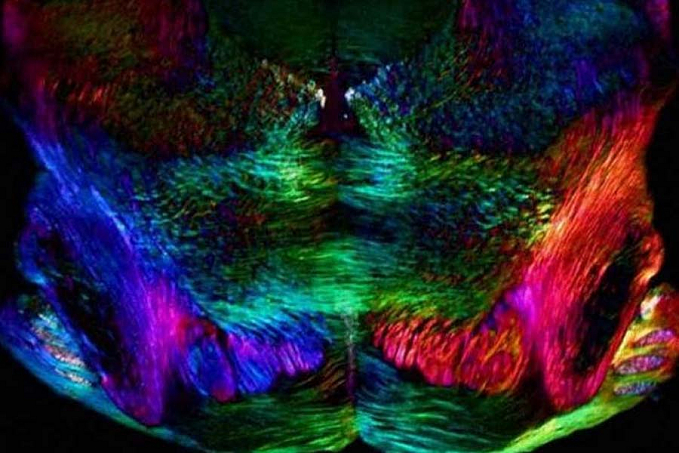 Cientistas revertem perda de memória com composto já usado em humanos - News Rondônia