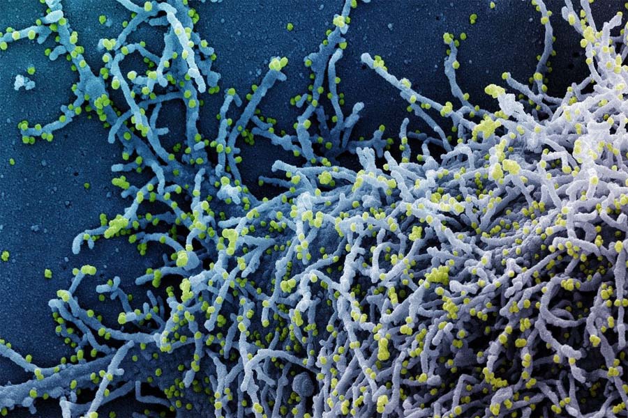 Covid-19: China deve aprovar 1º medicamento contra o vírus em dezembro - News Rondônia