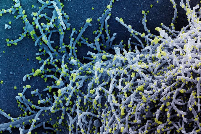 Covid-19: China deve aprovar 1º medicamento contra o vírus em dezembro - News Rondônia