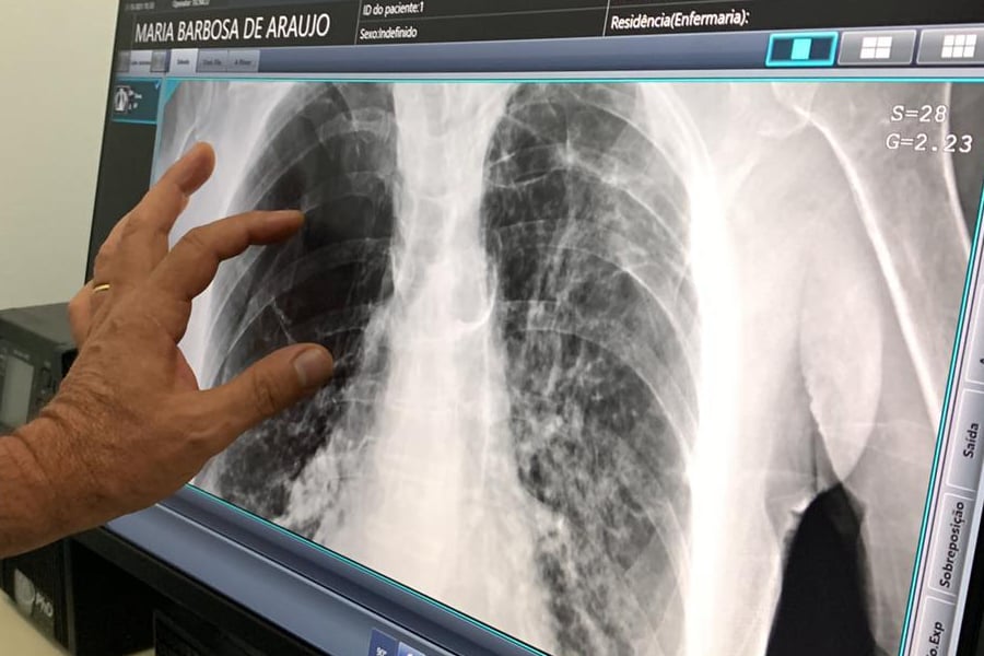 CREDENCIAMENTO - Aberto Chamamento Público para credenciar empresas que prestam serviços de radiodiagnóstico, tomografia e ressonância magnética - News Rondônia