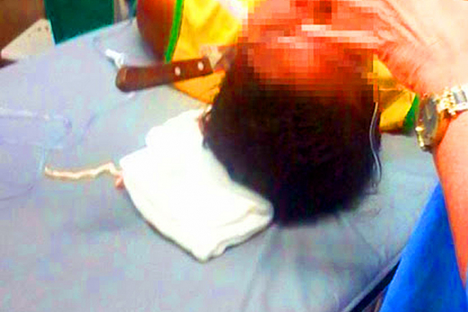 NO BAR: Mulher leva facada na cabeça ao defender amiga em briga na zona leste - News Rondônia