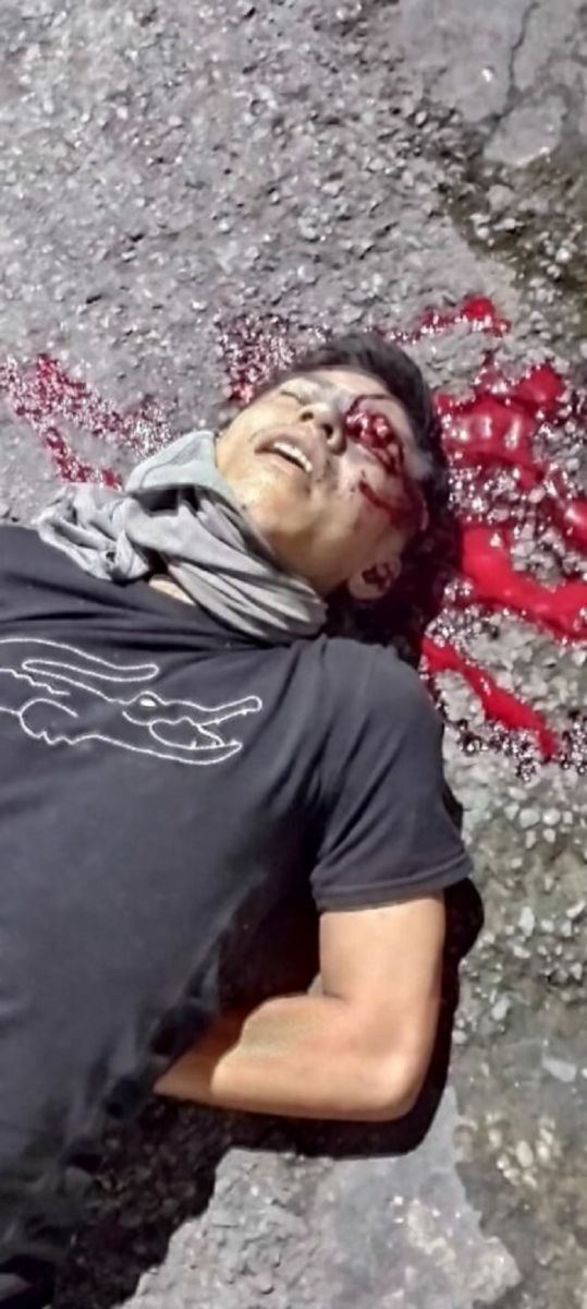 IMAGENS FORTES - Homem é crivado de bala na cabeça na zona leste de Manaus - News Rondônia