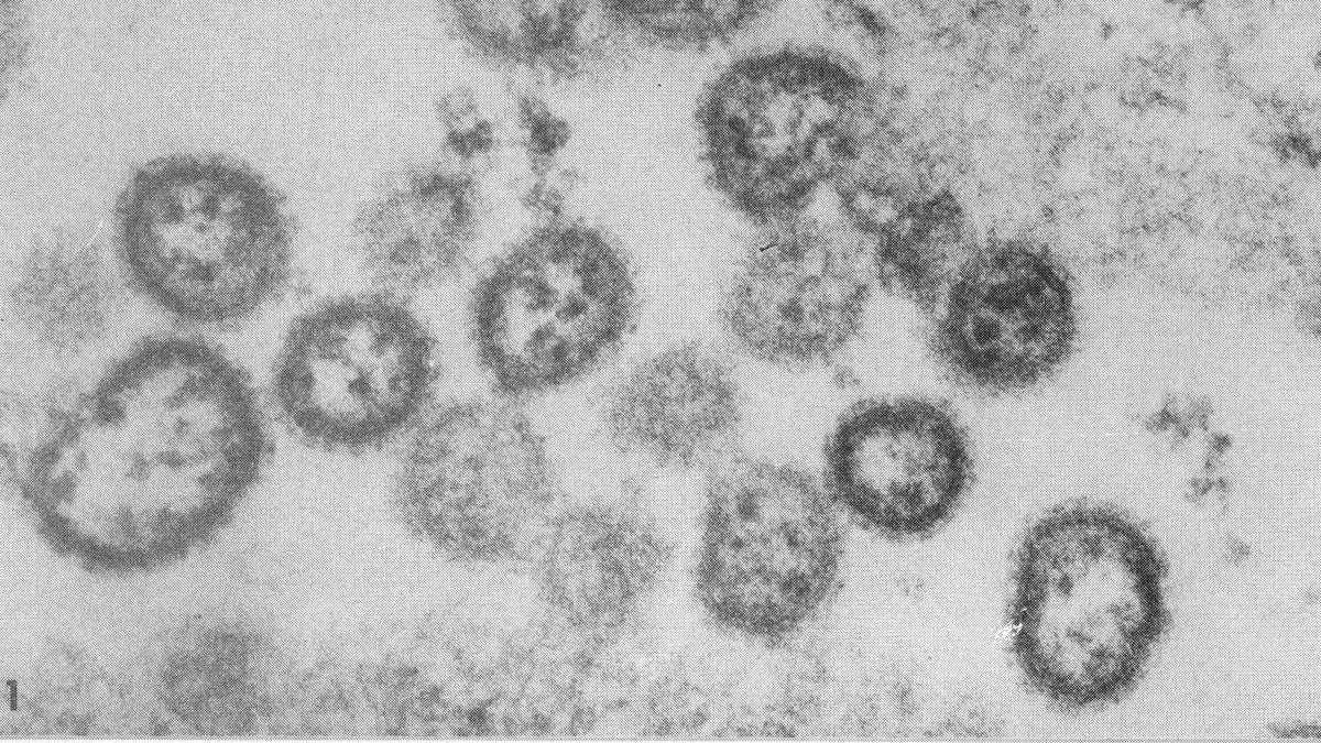 Cientistas detectam transmissão entre humanos de vírus letal na Bolívia - News Rondônia