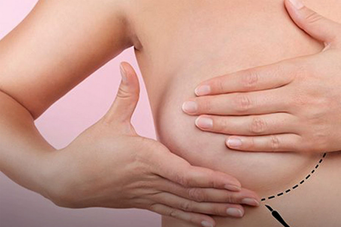 Femama alerta sobre mamografias após vacina contra covid-19 - News Rondônia