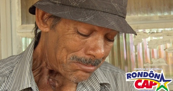 MORADOR DE ARIQUEMES QUE FAZ TRATAMENTO DE CÂNCER GANHA 40 MIL NO RONDONCAP - News Rondônia