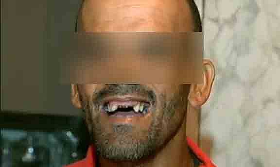 VALENTÃO - Homem perde quatro dentes durante briga - News Rondônia