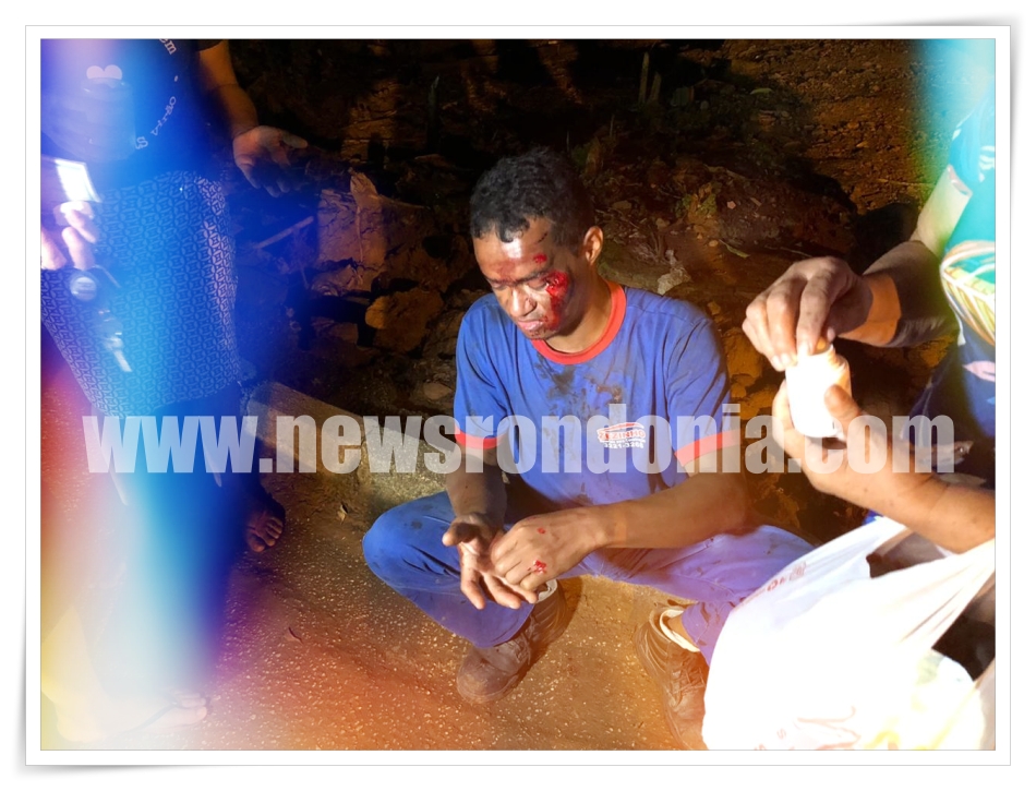 Ciclista fica com grave lesão no rosto após atropelar cachorro na zona sul da capital - News Rondônia