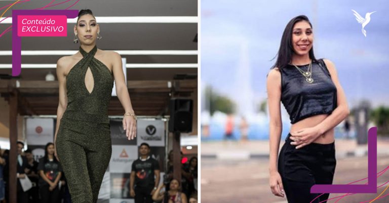 CONHEÇA A ANA VICTÓRIA, A PRIMEIRA MODELO COM MICROCEFALIA DO BRASIL E DO MUNDO - News Rondônia