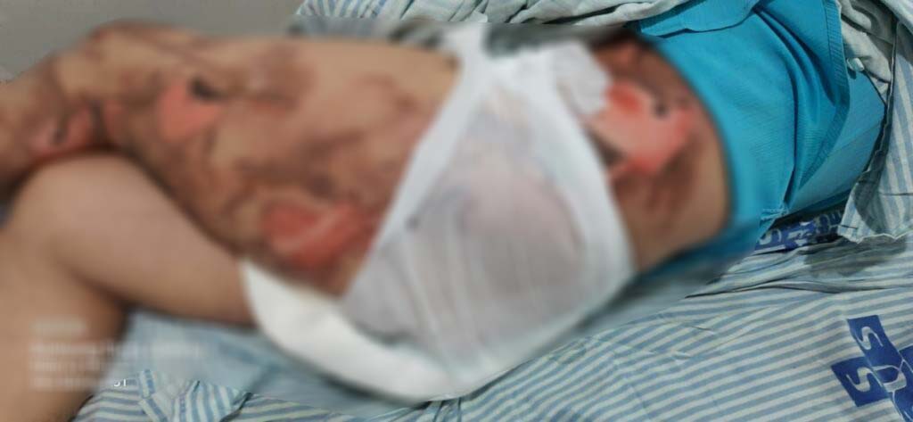 VEJA VÍDEO - Filho tranca idoso no quarto para ser queimado vivo em Rondônia - News Rondônia