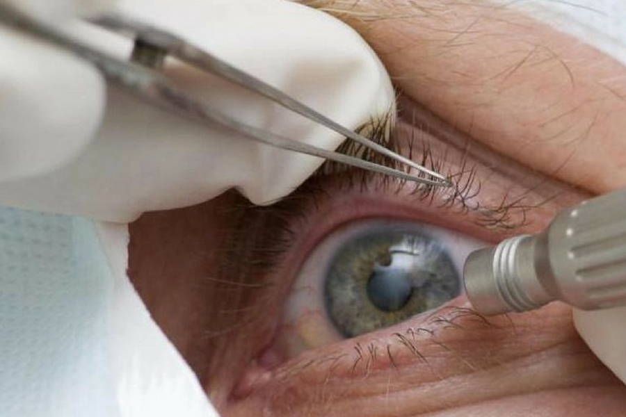 Consultas regulares ao médico podem afastar risco de glaucoma - News Rondônia