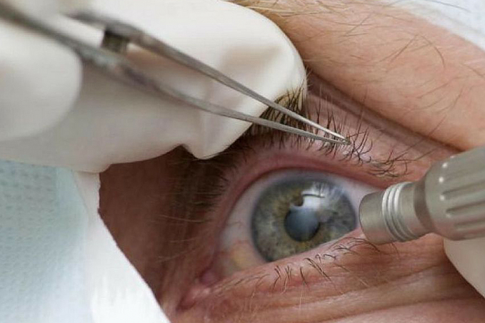 Consultas regulares ao médico podem afastar risco de glaucoma - News Rondônia