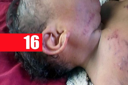 IMAGEM FORTE - PARA INTIMIDAR ESPOSA, HOMEM TORTURA BEBÊ DE 7 MESES - News Rondônia