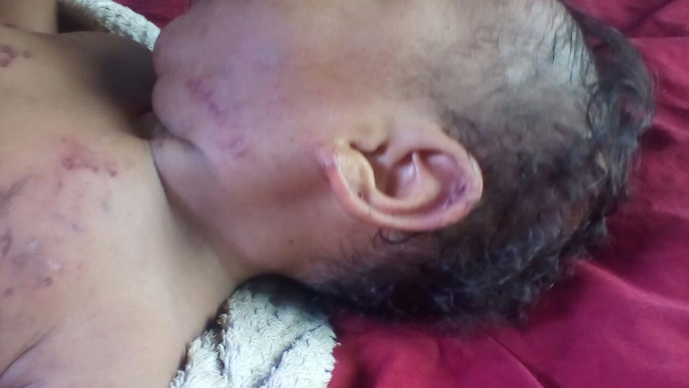 IMAGEM FORTE - PARA INTIMIDAR ESPOSA, HOMEM TORTURA BEBÊ DE 7 MESES - News Rondônia