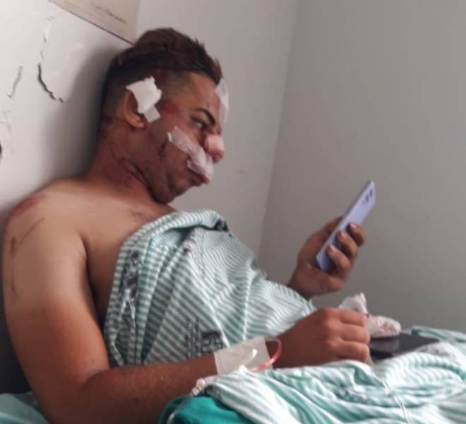 Cabeleireiro de 20 anos atropelado em Cerejeiras é operado em Vilhena e escreve: Deus fez um milagre na minha vida - News Rondônia