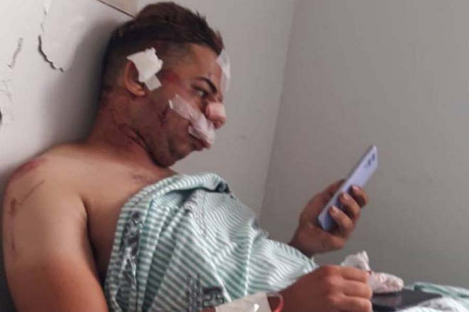 Cabeleireiro de 20 anos atropelado em Cerejeiras é operado em Vilhena e escreve: Deus fez um milagre na minha vida - News Rondônia
