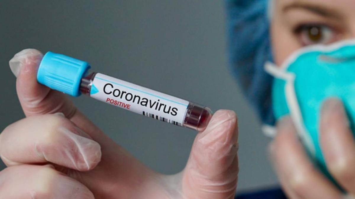 ABSURDO: LABORATÓRIO DÁ MAIS DE 20 MIL REAIS A QUEM TOPAR SER INFECTADO COM CORONAVÍRUS - News Rondônia