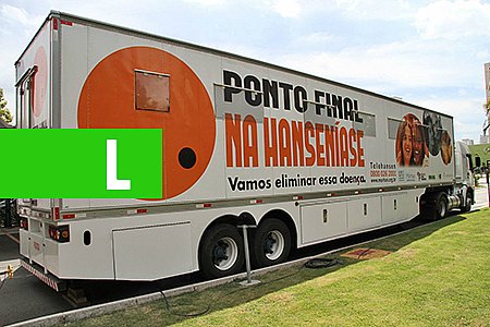 CARRETA DA SAÚDE PROMOVE ACESSIBILIDADE E POSSIBILITA DIAGNÓSTICO PRECOCE DE HANSENÍASE - News Rondônia