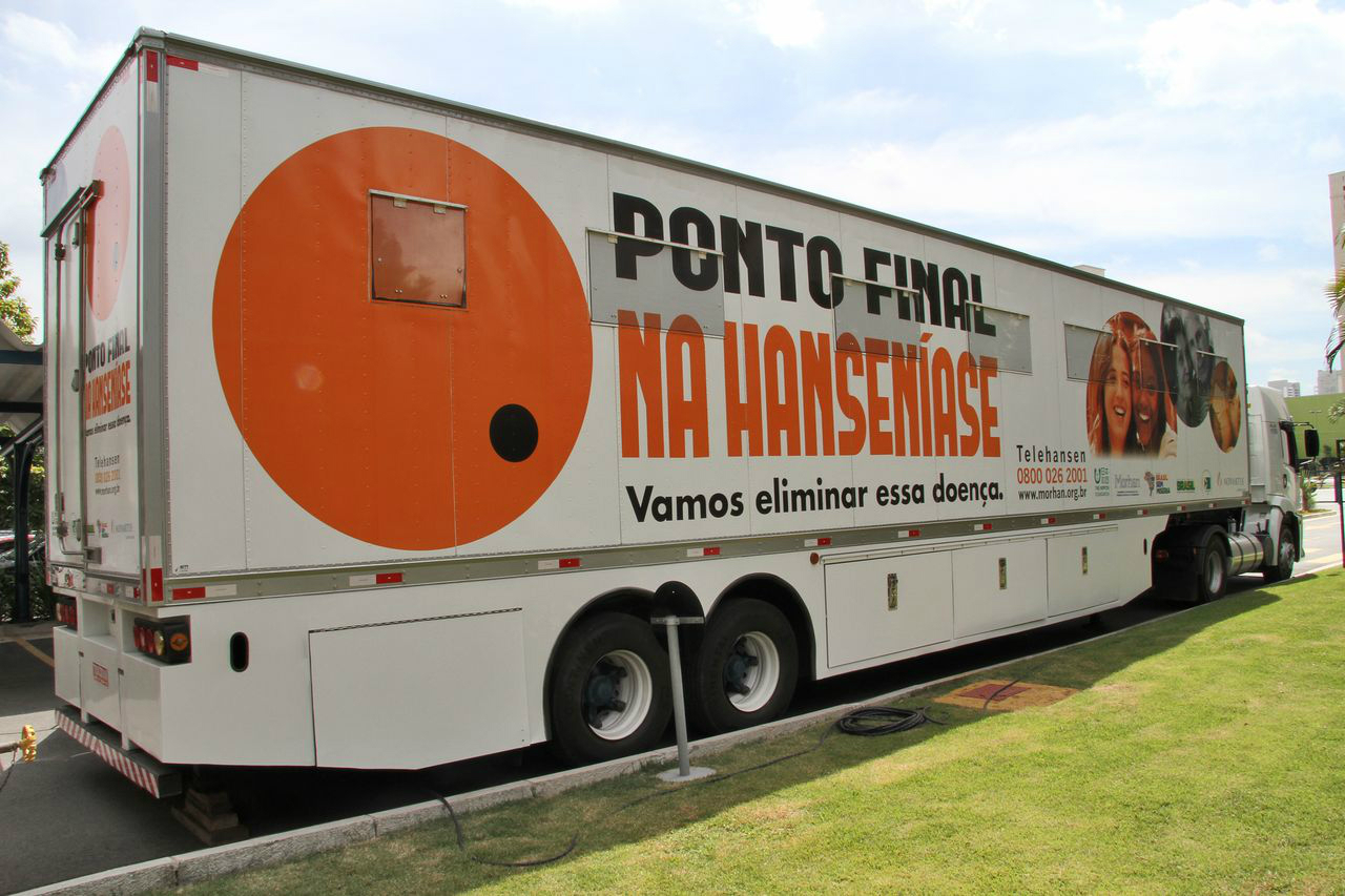 CARRETA DA SAÚDE PROMOVE ACESSIBILIDADE E POSSIBILITA DIAGNÓSTICO PRECOCE DE HANSENÍASE - News Rondônia