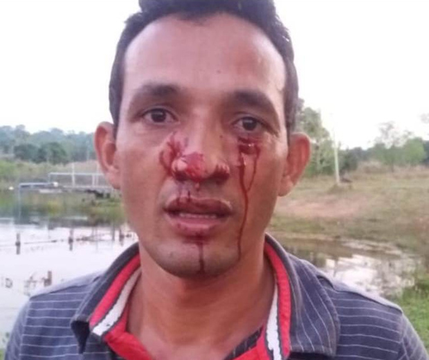 SUCURI ATACA HOMEM DURANTE PESCARIA - VEJA FOTOS - News Rondônia