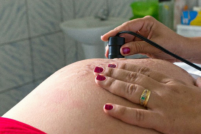 Número de óbitos de grávidas em 2021 já ultrapassa todo ano de 2020 - News Rondônia
