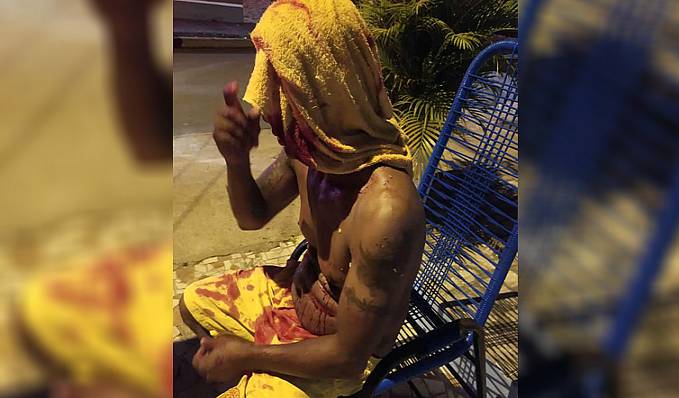 Homem sofre atentado à tiros em Ji-Paraná e acaba sendo baleado na cabeça - News Rondônia