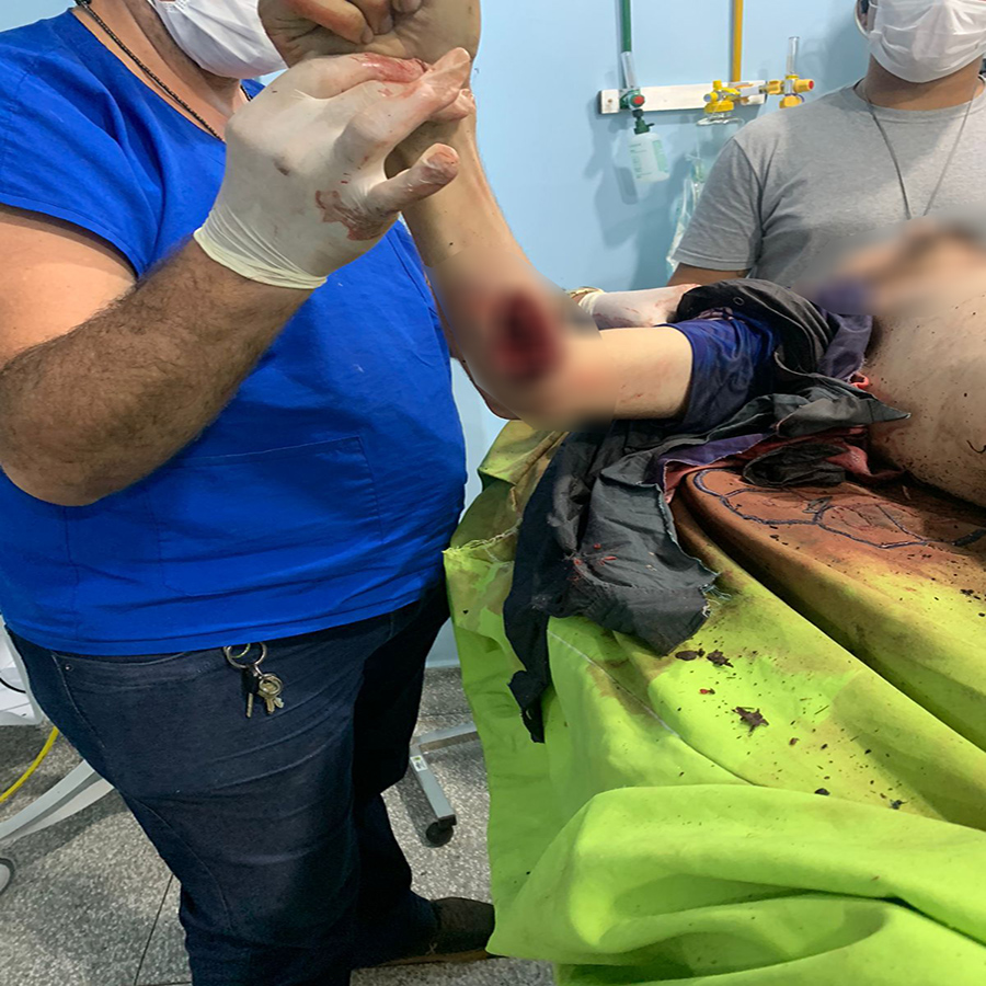VAZOU - Fotos do bandido Gideon morto em confronto com a PM - News Rondônia