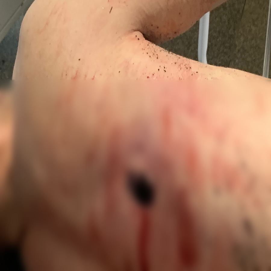 VAZOU - Fotos do bandido Gideon morto em confronto com a PM - News Rondônia