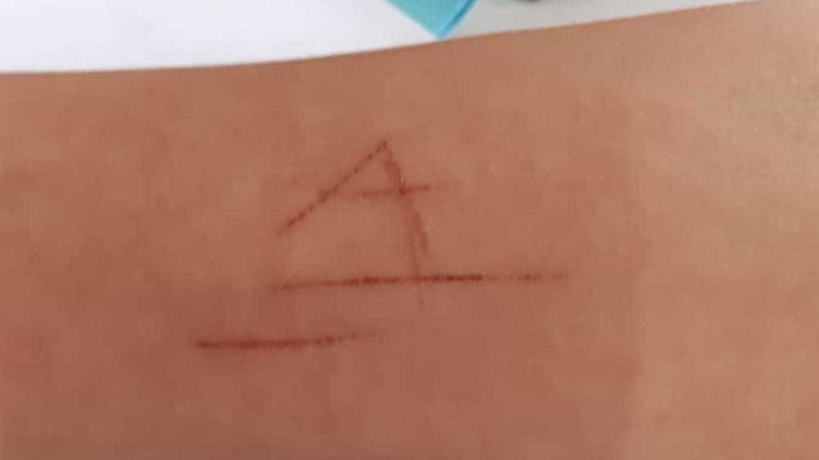 ESTUDANTE É DOPADA, ESTUPRADA E TEM PULSO MARCADO PELA LETRA 'A' - News Rondônia