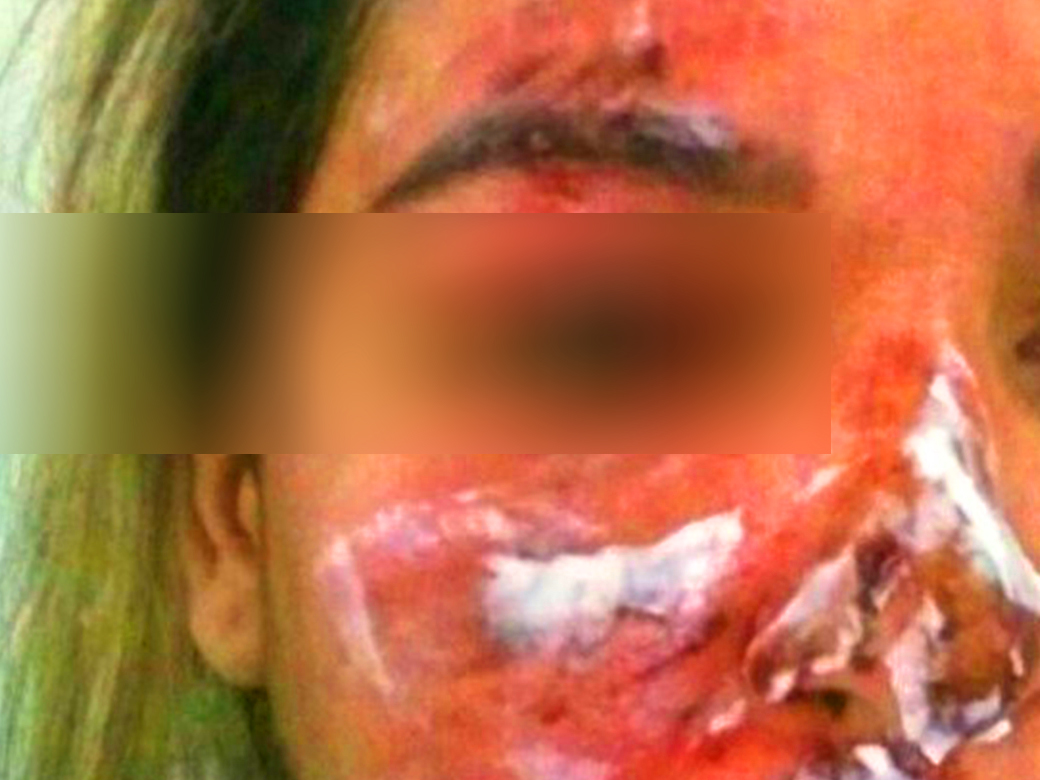 ROSTO DESFIGURADO - Com bebê de 7 meses no colo, mulher é espancada pelo marido - News Rondônia